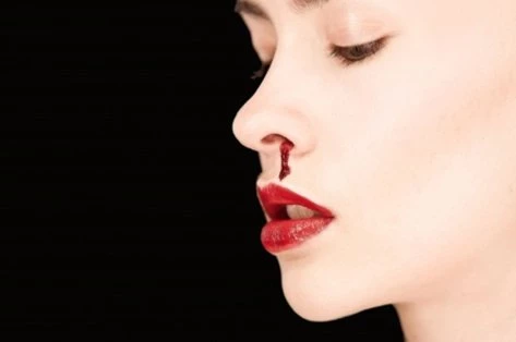 Ρινορραγίες: Πώς να τις σταματήσετε – Τα πιο συνηθισμένα λάθη